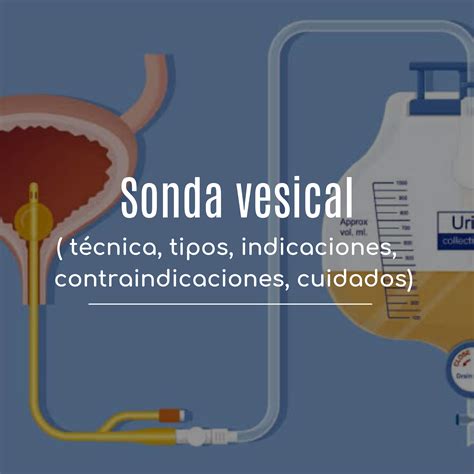 sonda vesical mujer real|Sondaje vesical en mujeres